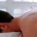 Acupuntura somente poderá ser exercida por médicos